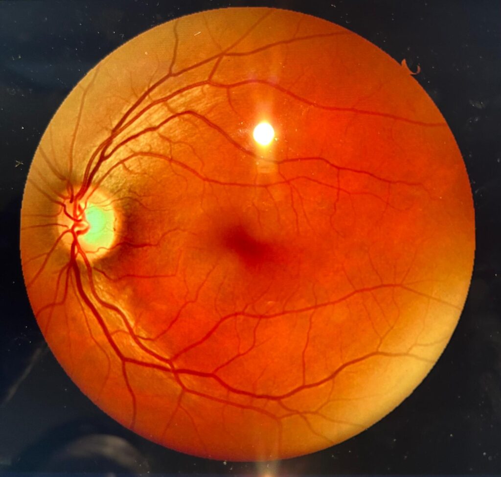 ophtalmologie